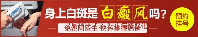 身上白斑就是白癜风吗